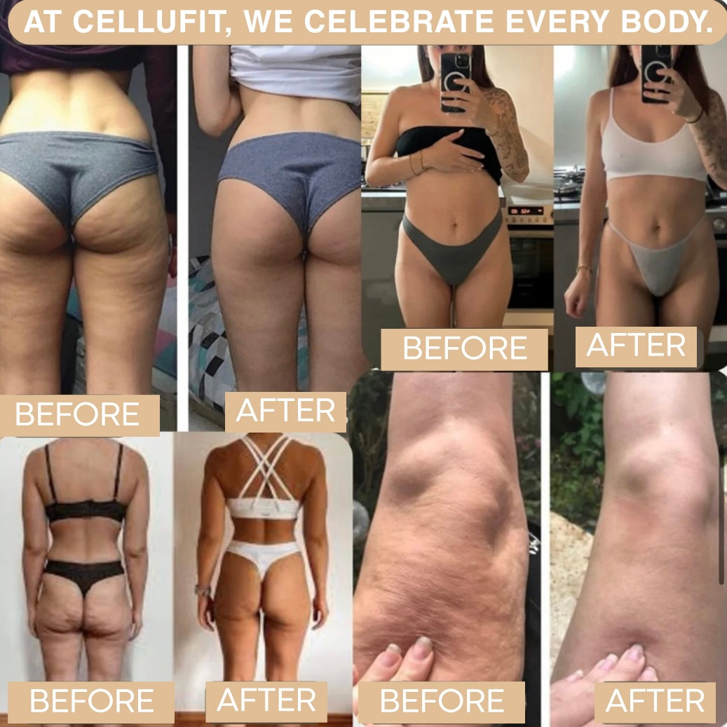 CELLUFIT™ – Leggings 3D Anti-Cellulite