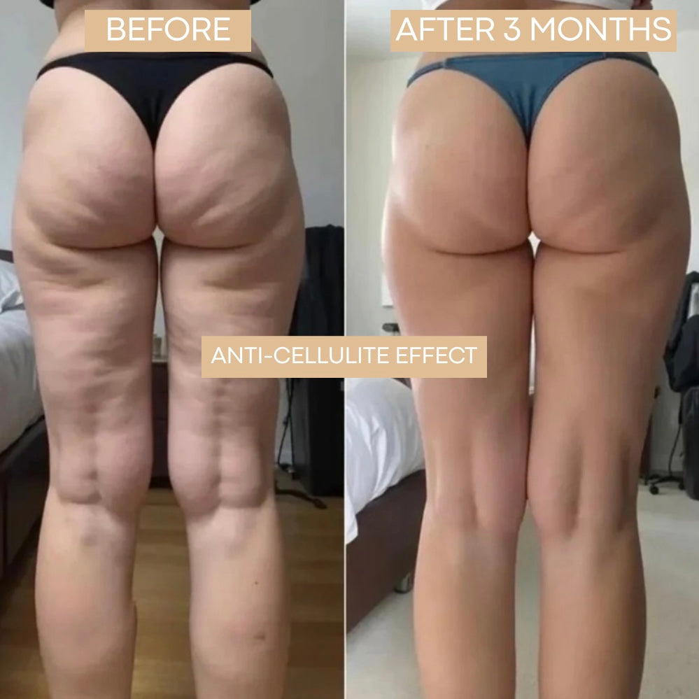 CELLUFIT™ – Leggings 3D Anti-Cellulite