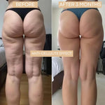 CELLUFIT™ – Leggings 3D Anti-Cellulite