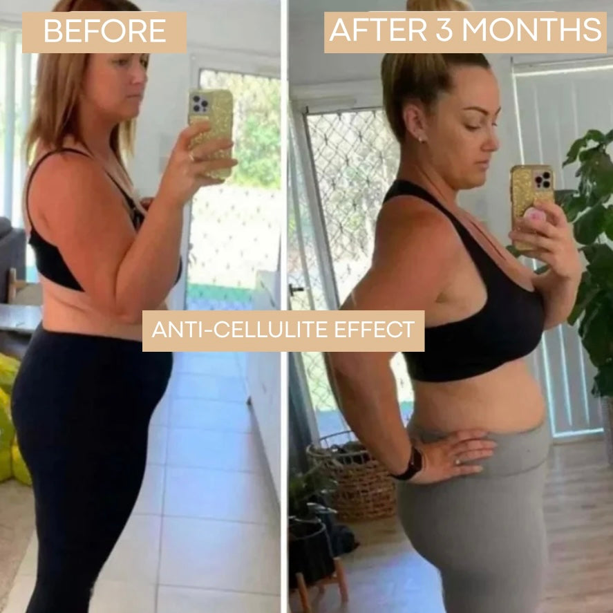 CELLUFIT™ – Leggings 3D Anti-Cellulite